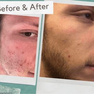 Men Skincare Lumispa Basic Kit